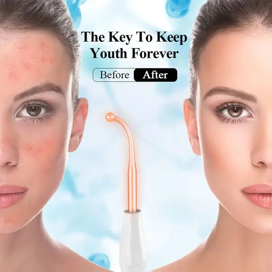 4-in-1 High Frequency Facial Massager